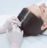 S-DSC毛髪再生医療について