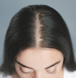 薄毛のメカニズム