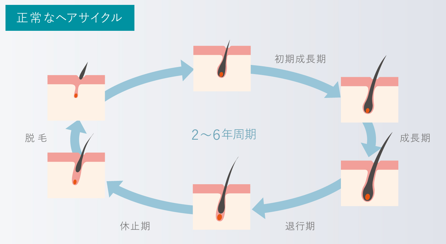 正常なヘアサイクル