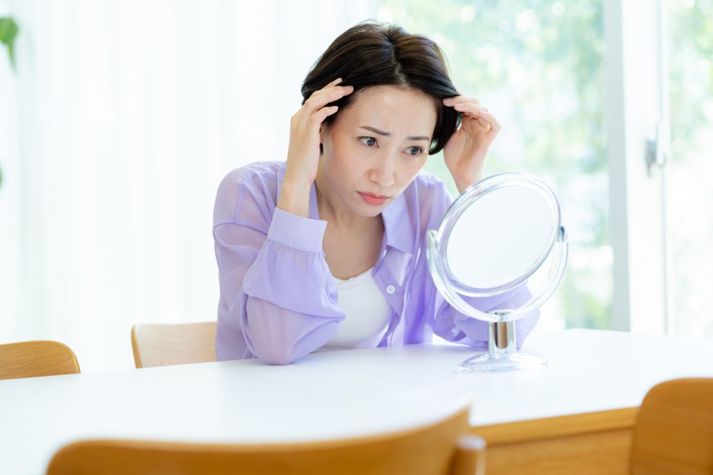 女性　50代　薄毛